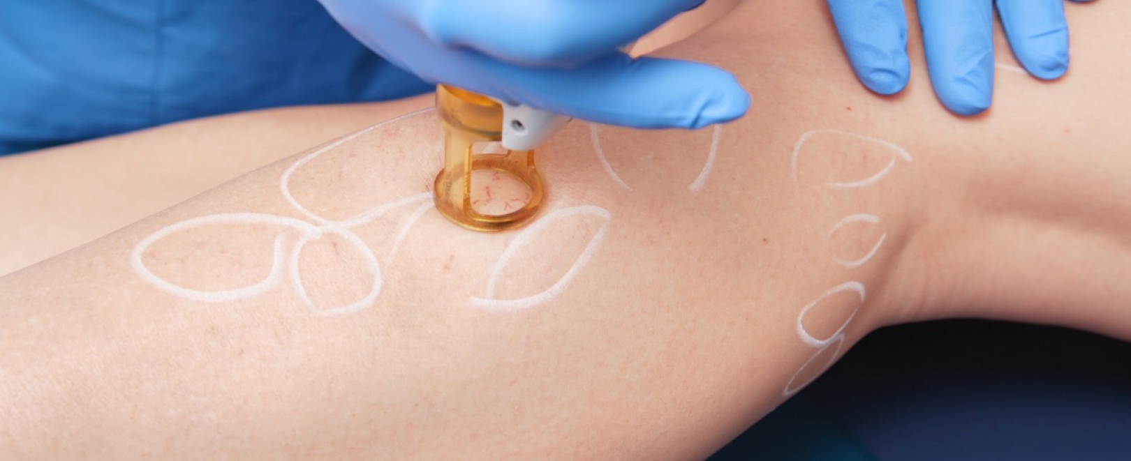 Individuelle Gesundheitsleistungen