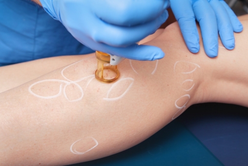 Individuelle Gesundheitsleistungen